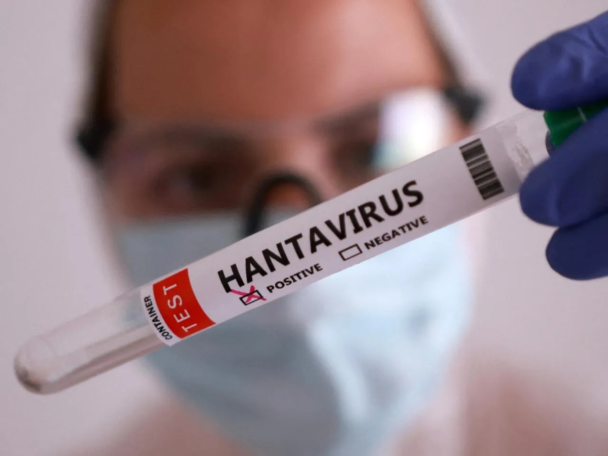 Venezuela confirmó tres muertes por hantavirus