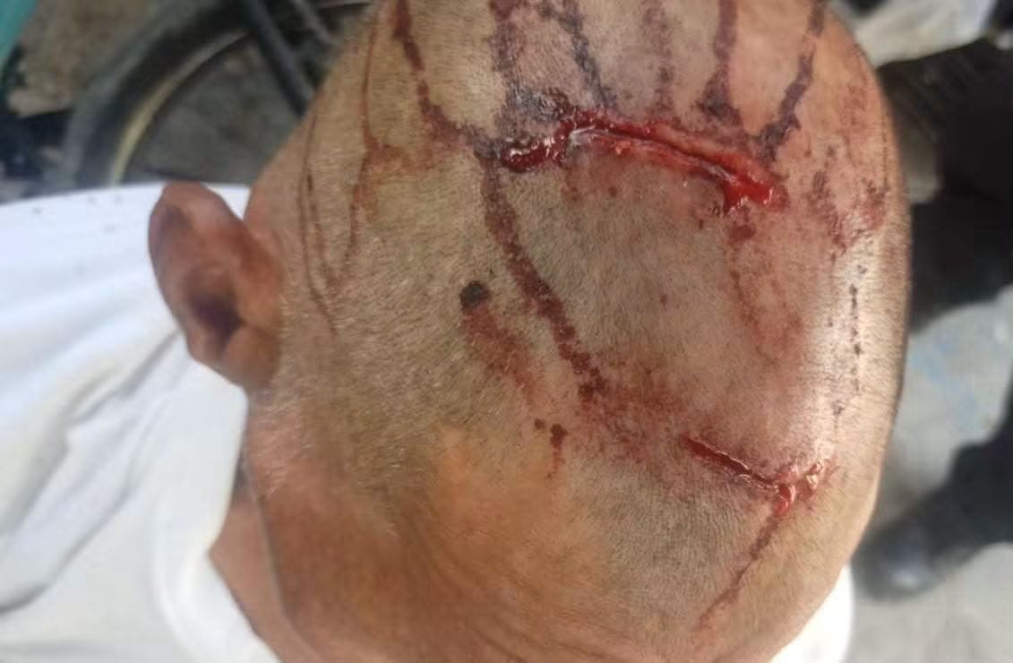 Agresión.: Paramédicos del Cuerpo de Bomberos acudieron al sitio y localizaron a Samuel García de la Rosa, quien presentaba heridas.