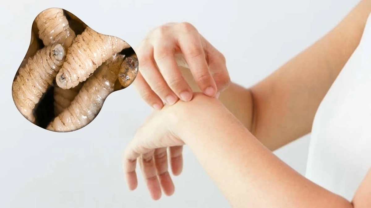 foto Así se detecta el gusano barrenador en perros y gatos: 7 síntomas y tratamientos que debes conocer