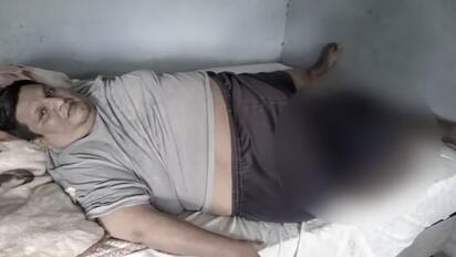 Extirparon un tumor de 40 kilos a un paciente que llevaba cinco años sin poder caminar