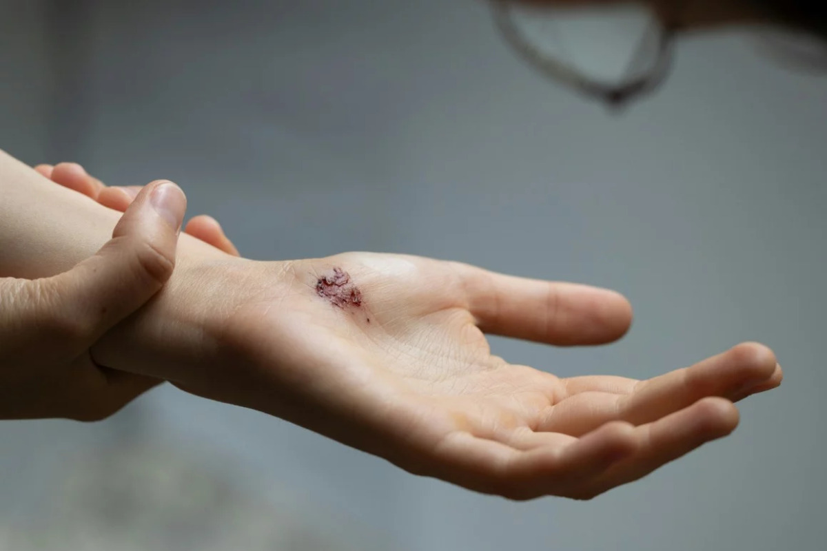 infecciones infecciones