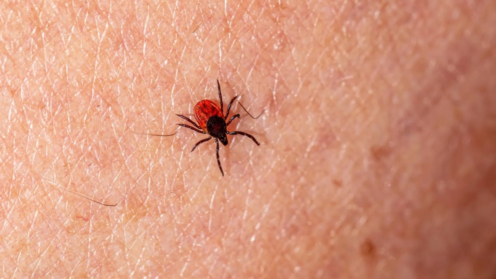 ENFERMEDADES Las autoridades sanitarias de Durango informaron que en la región de La Laguna se han confirmado cinco casos de rickettsiosis y tres fallecimientos