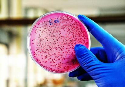 Autoridades sanitarias de Estados Unidos alertaron por un brote de E. coli relacionado con blueberries congelados y frutos rojos retirados del mercado.