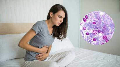 Ciclosporiasis: cuáles son los síntomas, cómo se contagia y cómo prevenirla