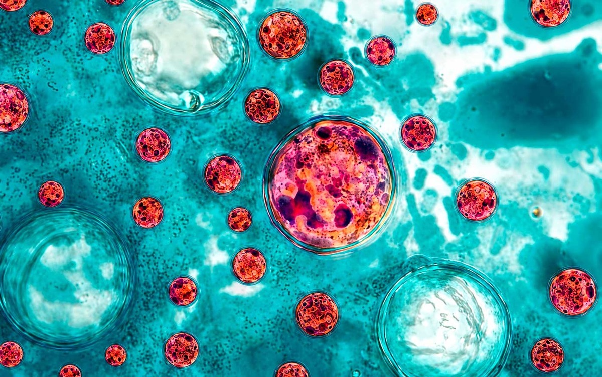 Secretaría de Salud confirma 33 casos de ciclosporiasis en México