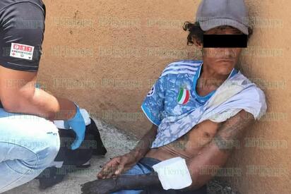 Migrante llega con el brazo en estado de necrosis a motel de Frontera; analizan posible amputación