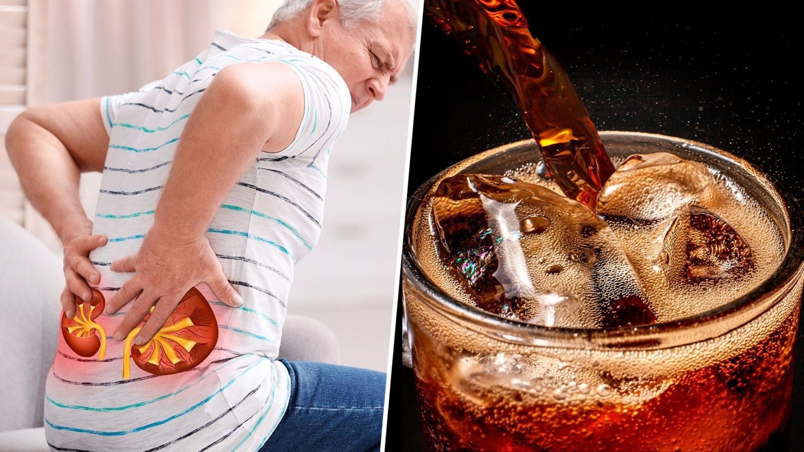 Beber un refresco ocasionalmente no significa que una persona vaya a desarrollar una enfermedad renal. Sin embargo, cuando estas bebidas forman parte habitual