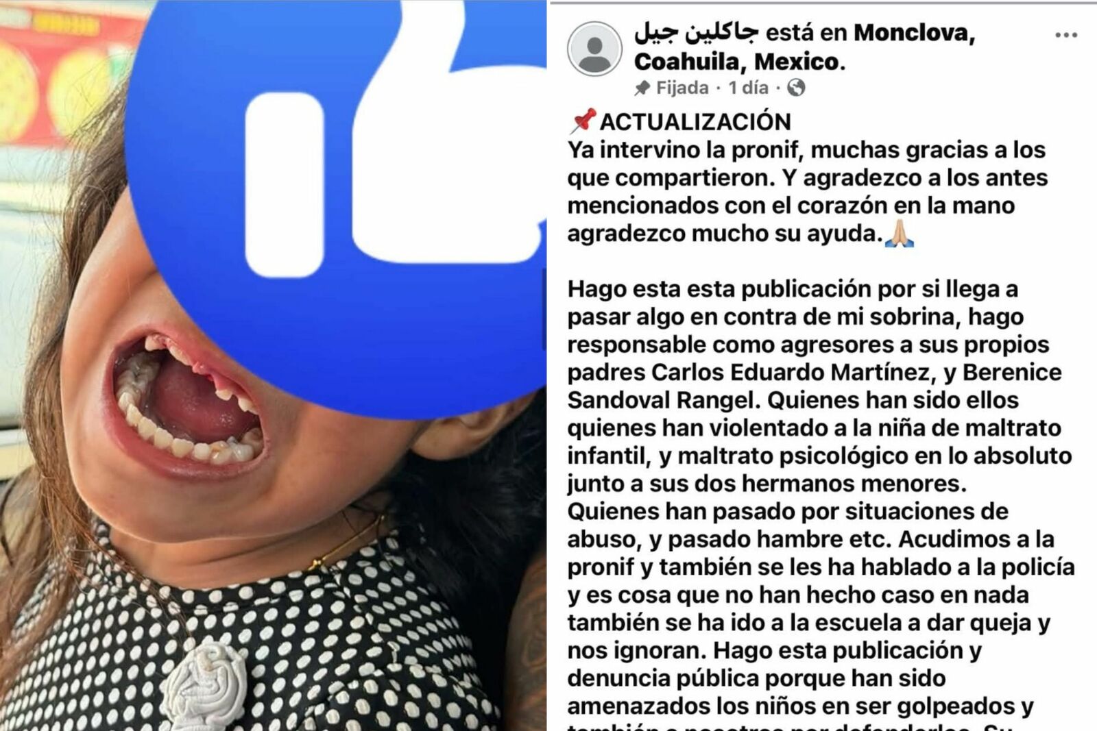 PRONNIF aclara denuncia de presunto maltrato infantil a niña que perdió dentadura