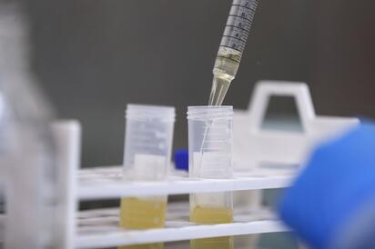 Descartan casos sospechosos de rickettsia y refuerzan vigilancia sanitaria en PN