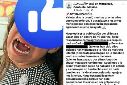 PRONNIF aclara denuncia de presunto maltrato infantil a niña que perdió dentadura
