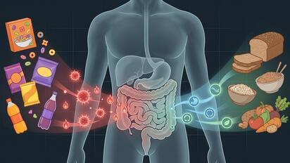 Ultraprocesados tienen hasta 30% más riesgo de cáncer de próstata