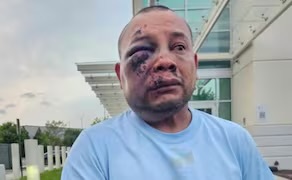 Mexicano detenido por ICE en Virginia despierta en hospital