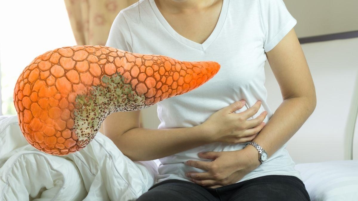 FDA aprueba prometedor fármaco contra el cáncer de páncreas