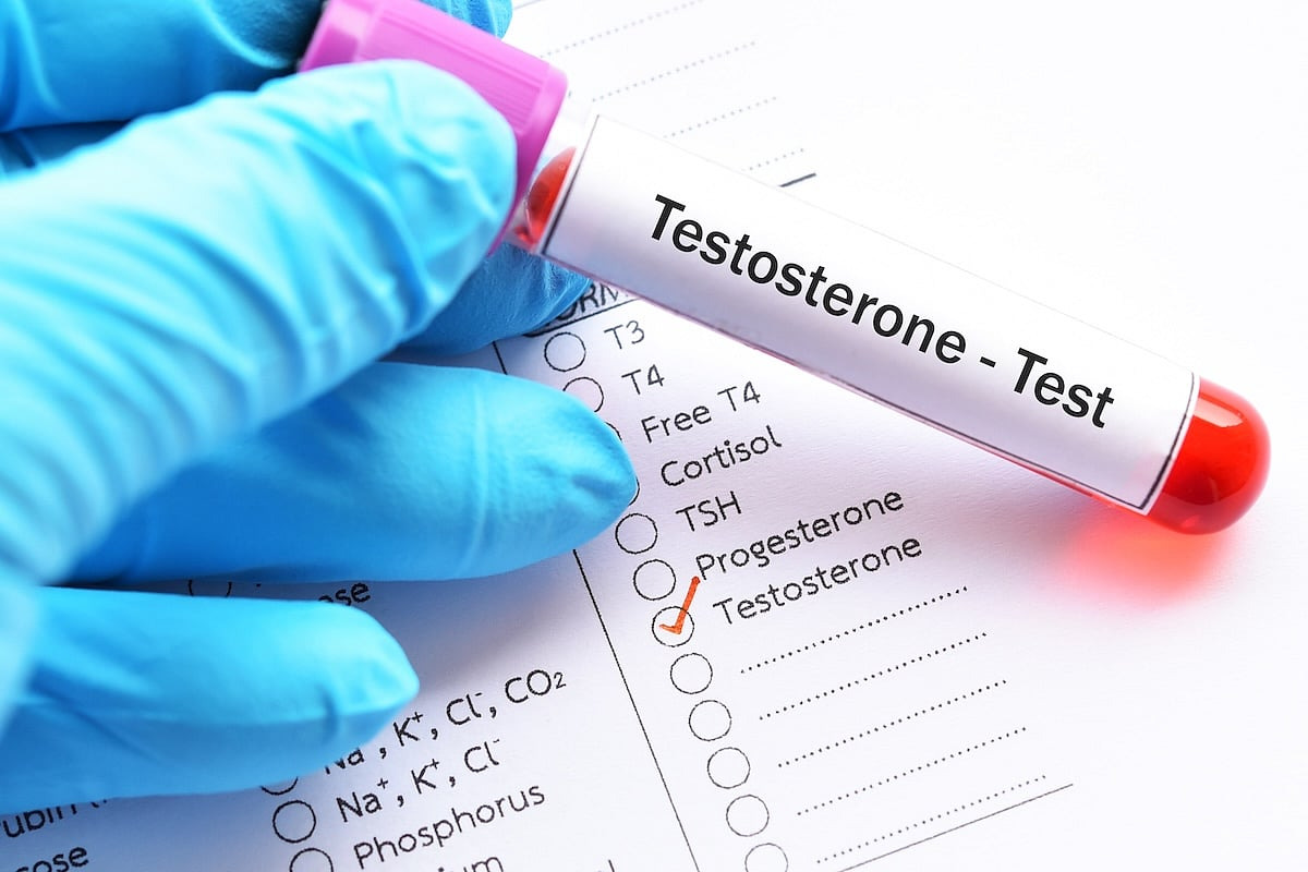 La testosterona alta aumenta el riesgo de trastorno del ritmo cardíaco