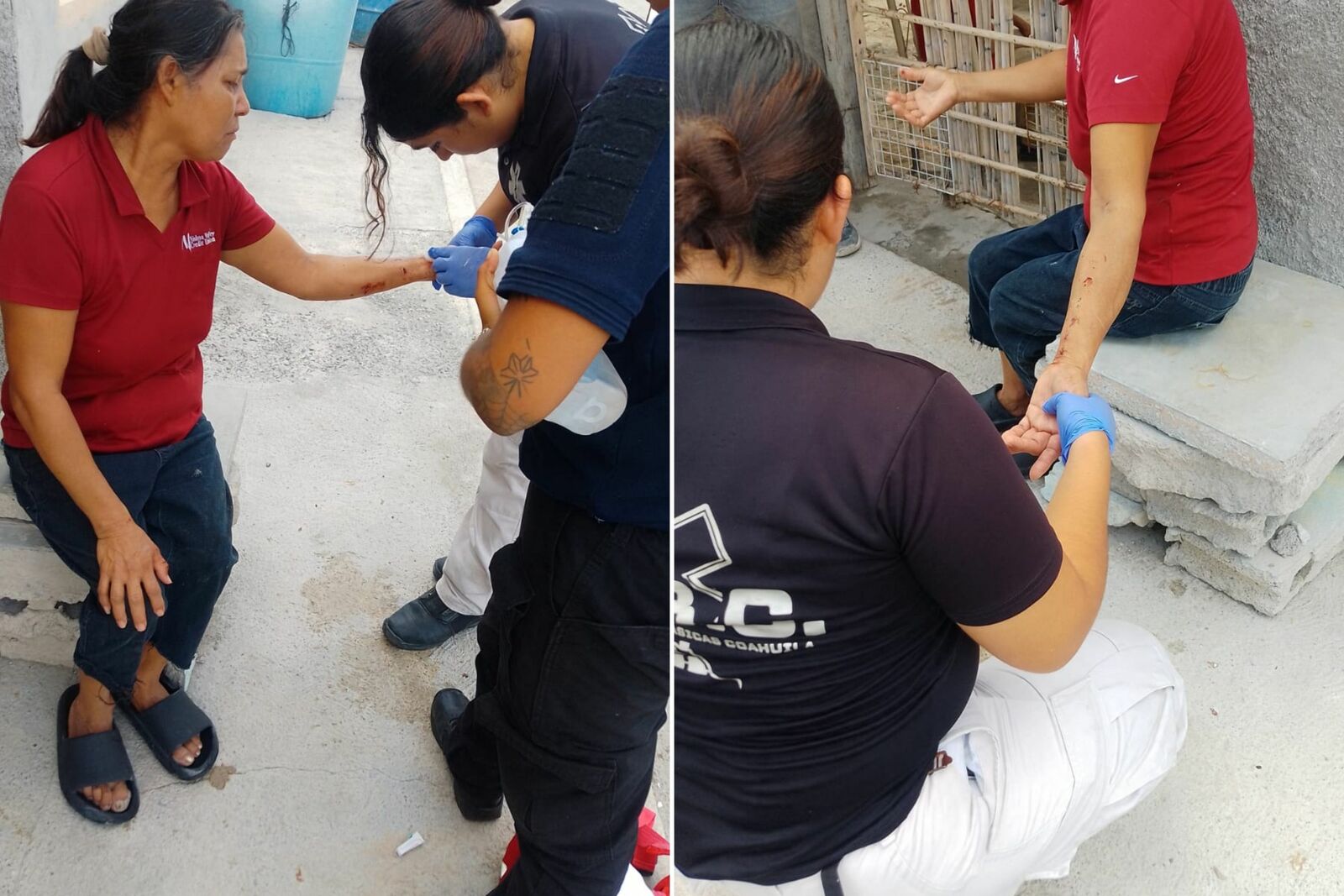 Mujer resulta mordida por un pitbull al intentar separar a dos perros