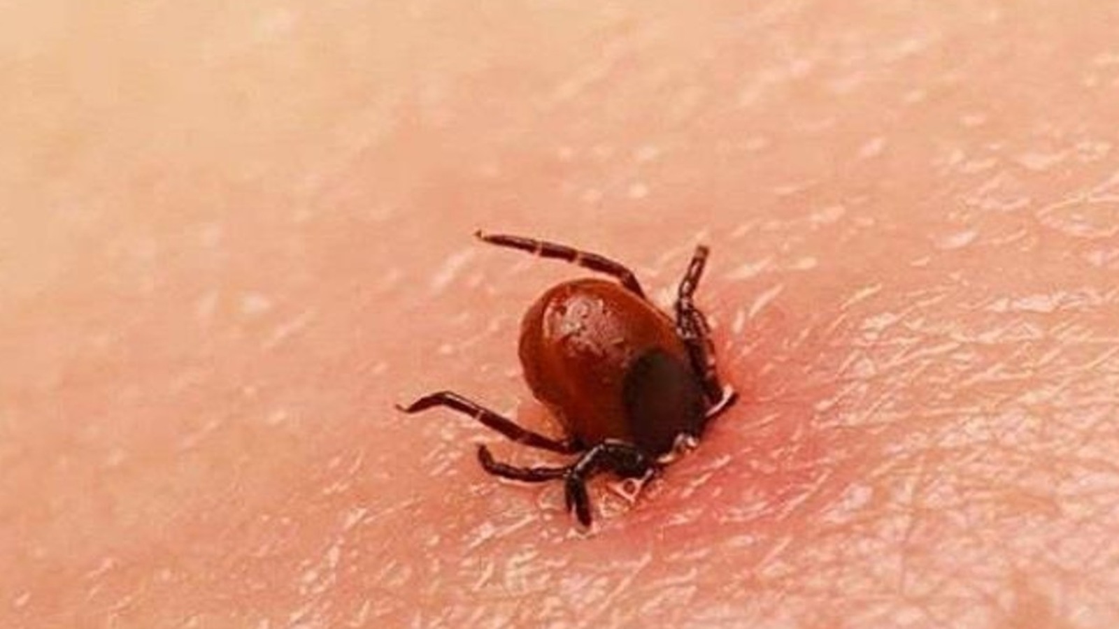 SALUD Autoridades sanitarias investigan el fallecimiento de una menor y exhortan a detectar síntomas tempranos para evitar complicaciones graves por rickettsiosis.