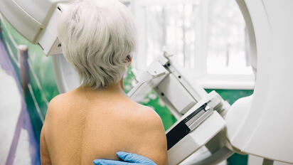 Menos sobrediagnóstico en el cribado de cáncer de mama de lo que se pensaba
