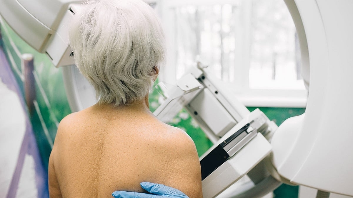 Menos sobrediagnóstico en el cribado de cáncer de mama de lo que se pensaba
