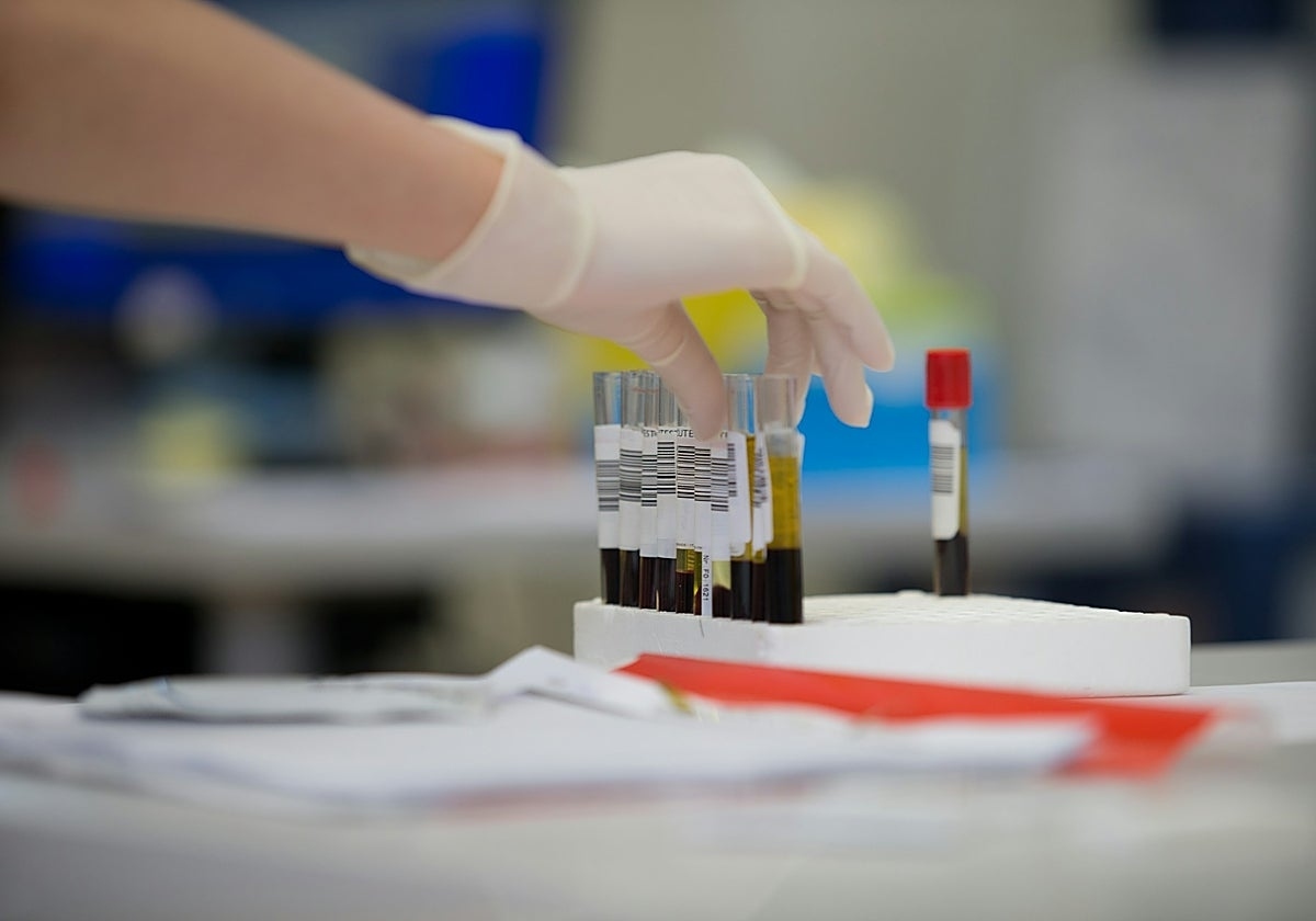 Los cambios en los análisis de sangre podrían ayudar a detectar el riesgo de cáncer