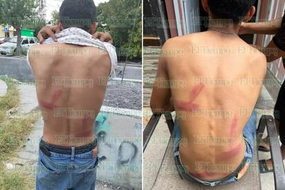 Tíos lo tablean y termina en el hospital en Monclova