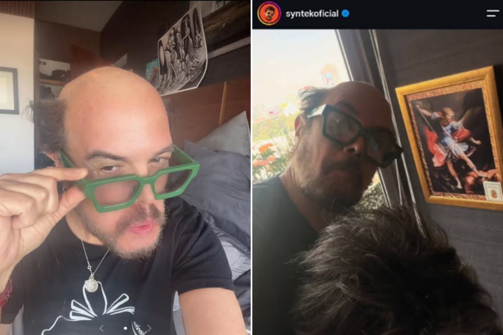 Aleks Syntek publica mensajes preocupantes tras aparecer sin peluquín