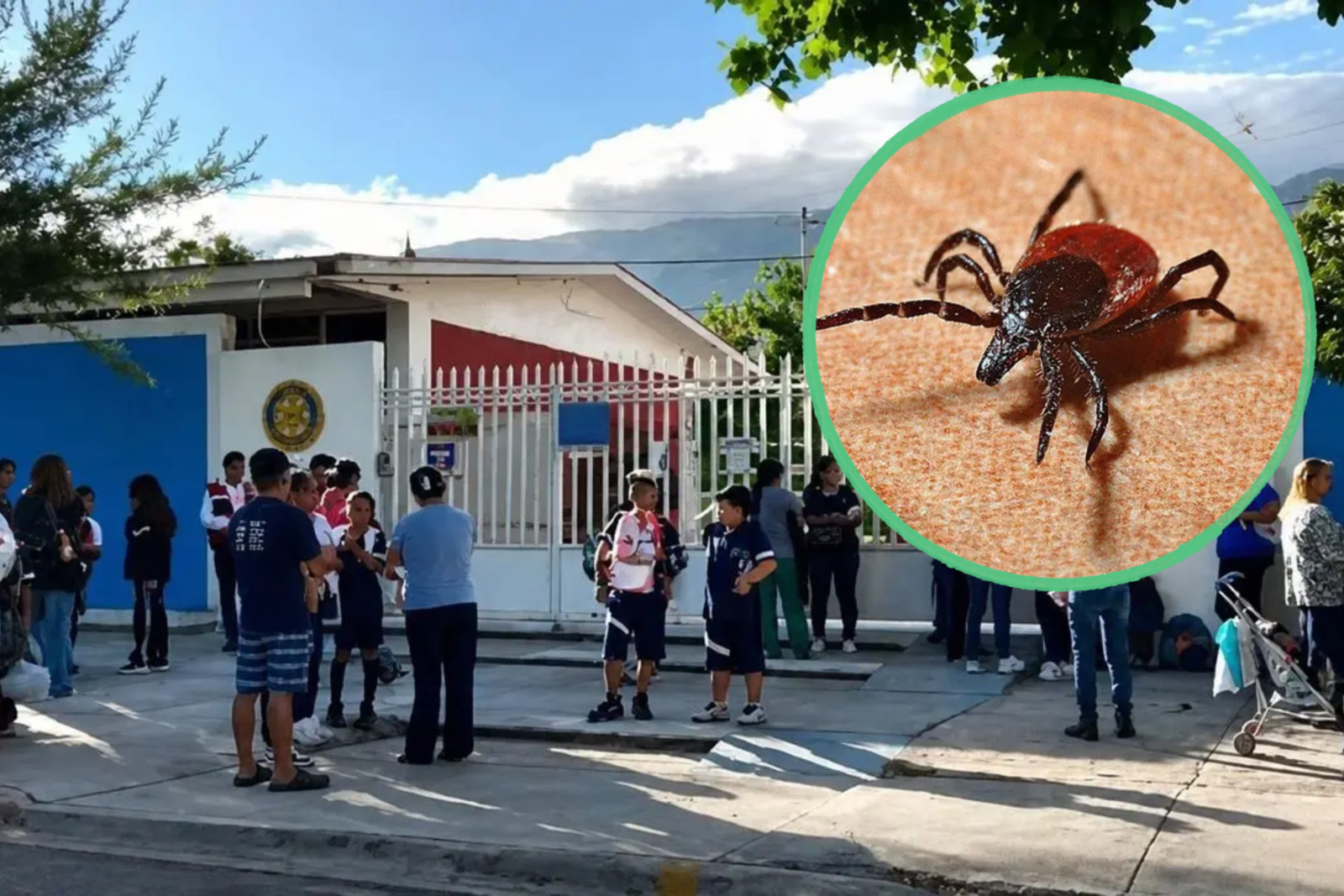 Atienden caso de picadura de garrapata en primaria de Saltillo