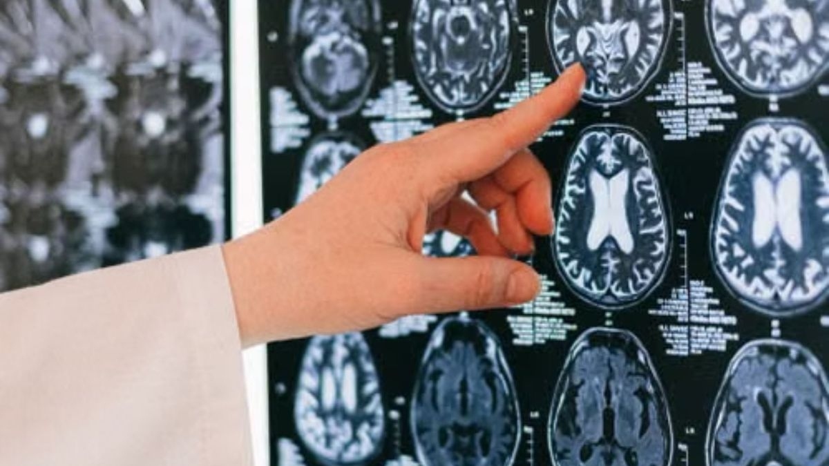 Optogenética: el interruptor de luz que transformó el estudio del cerebro