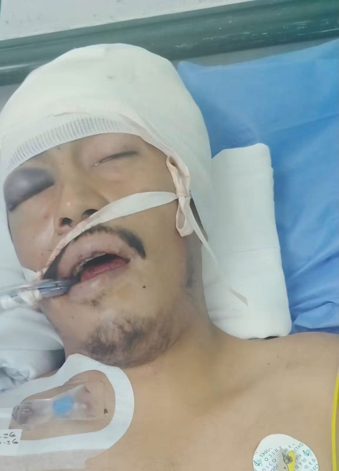 Muere motociclista de 28 años tras varias horas de agonía en Piedras Negras
