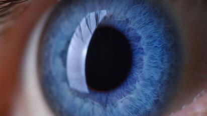Nuevo lente intraocular experimental podría permitir tratar las cataratas y el glaucoma