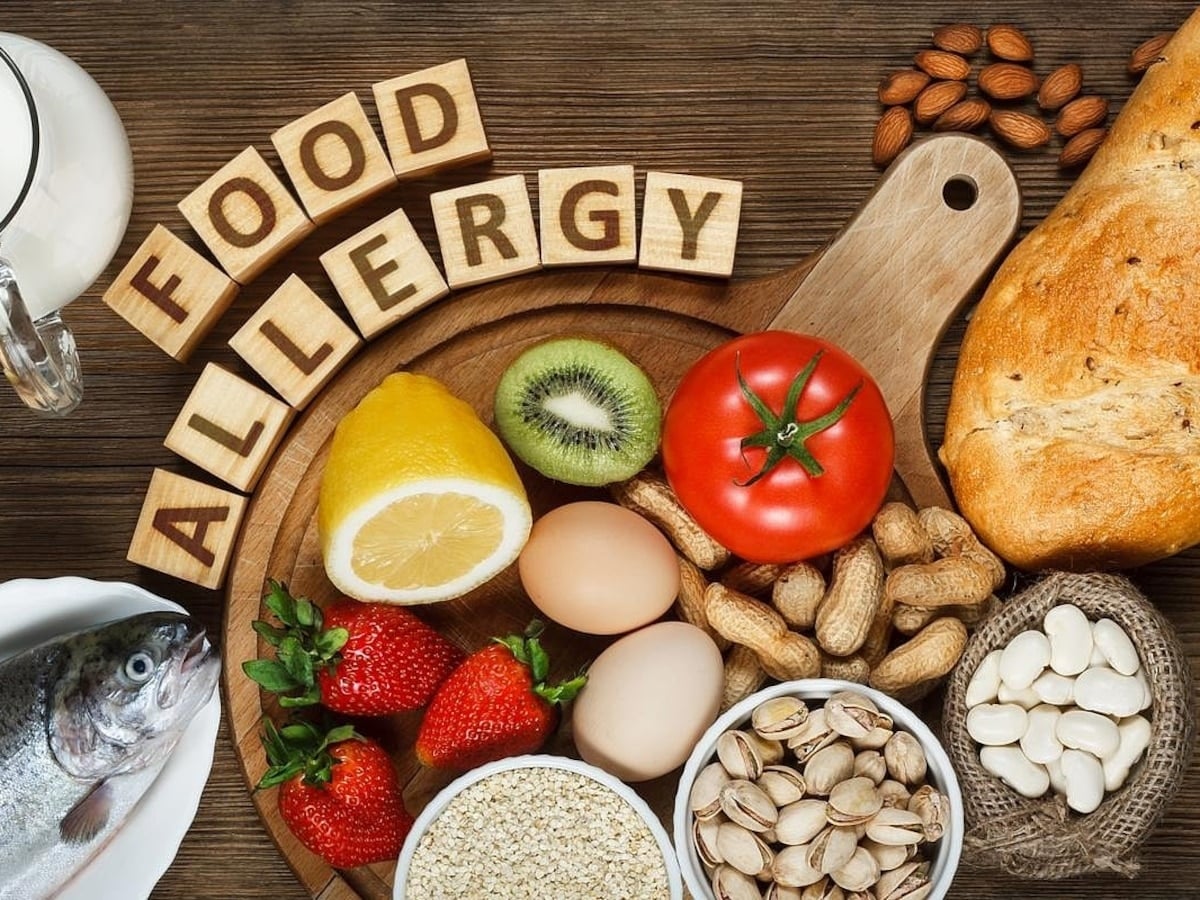 Las alergias alimentarias cambian durante los primeros años de vida
