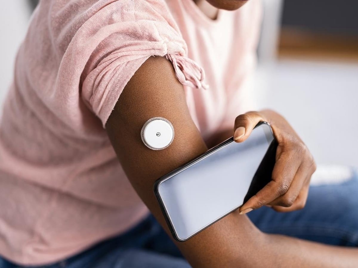 Los monitores continuos de glucosa podrían mejorar el control de la diabetes tipo 2