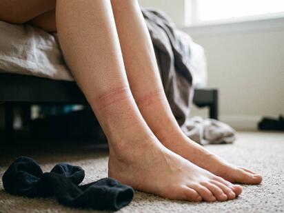 La hinchazón de los pies, tobillos y piernas puede aparecer después de pasar muchas horas sentado o de pie, por el calor o debido a problemas de circulación.