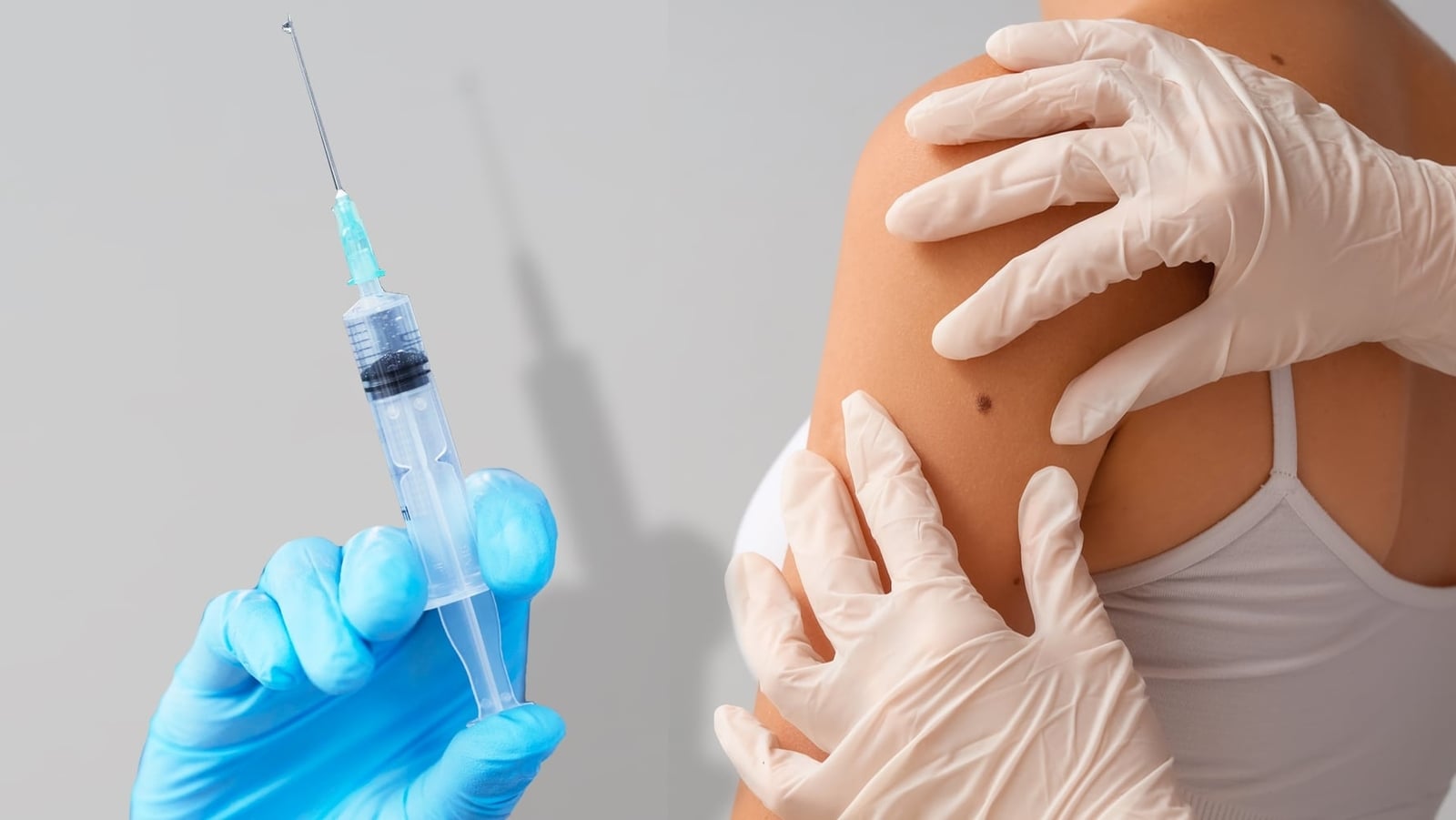 Vacuna personalizada contra el melanoma: resultados prometedores generan dudas