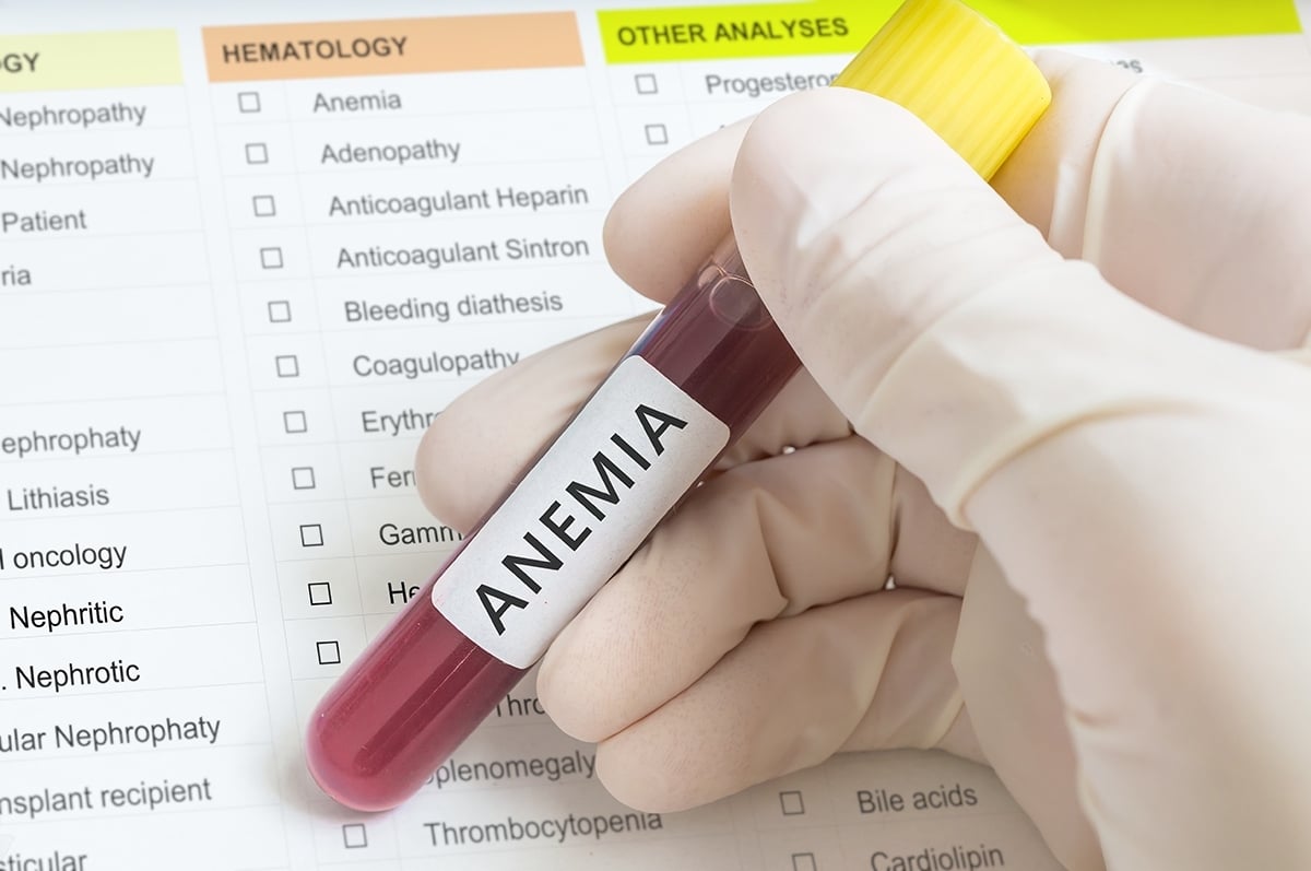 Anemia en adultos mayores: una señal que podría revelar alteraciones de la médula 