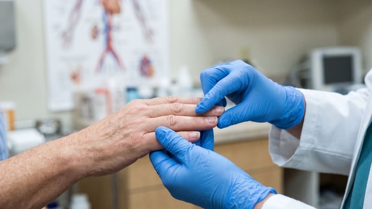 7 cambios en las uñas que podrían indicar un problema de salud